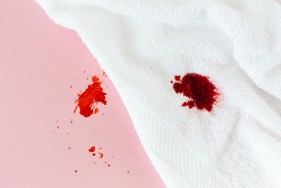 Bleached spot on white fabric from benzoyl peroxide